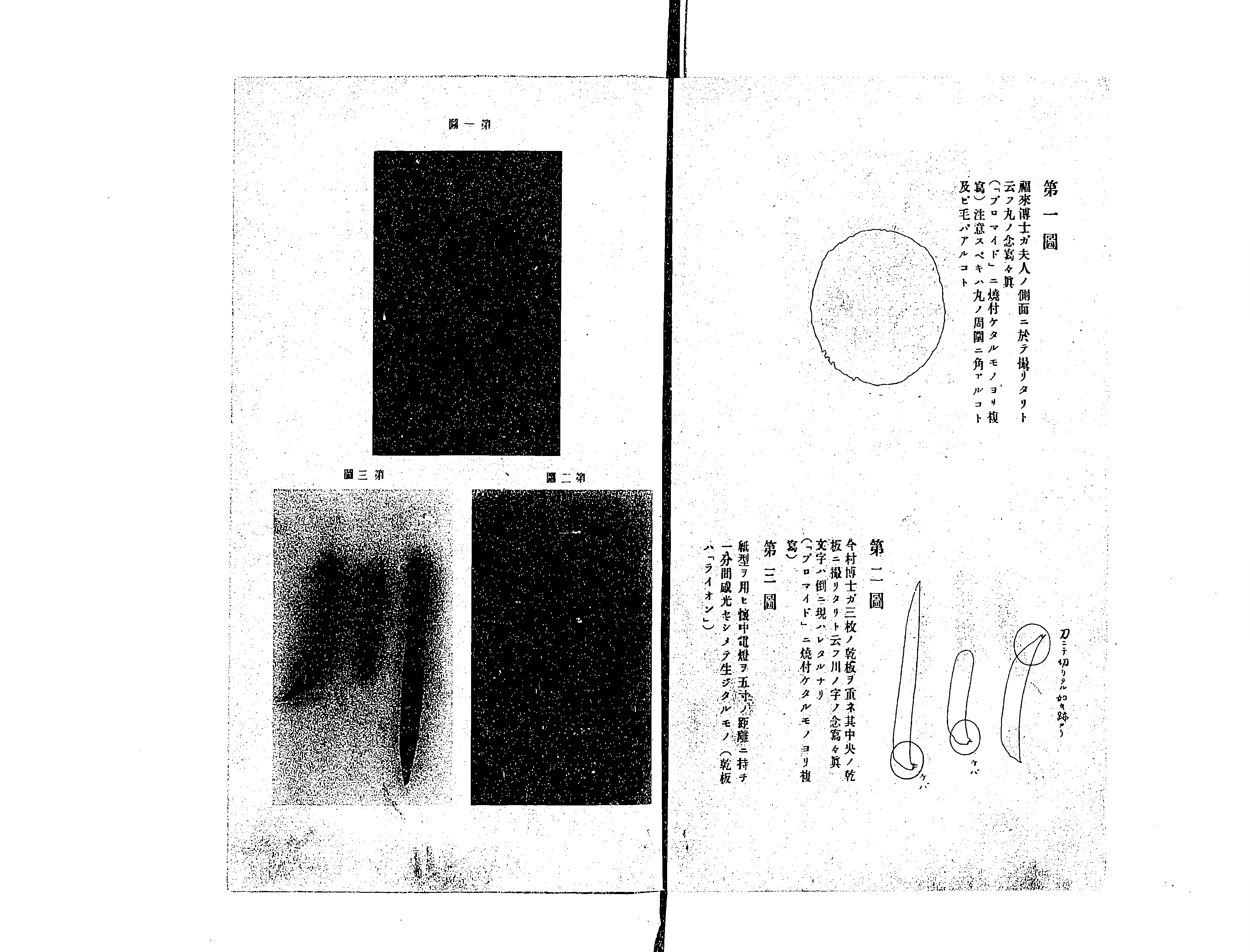 Frontispiece figures 1–3 and the accompanying outline drawings