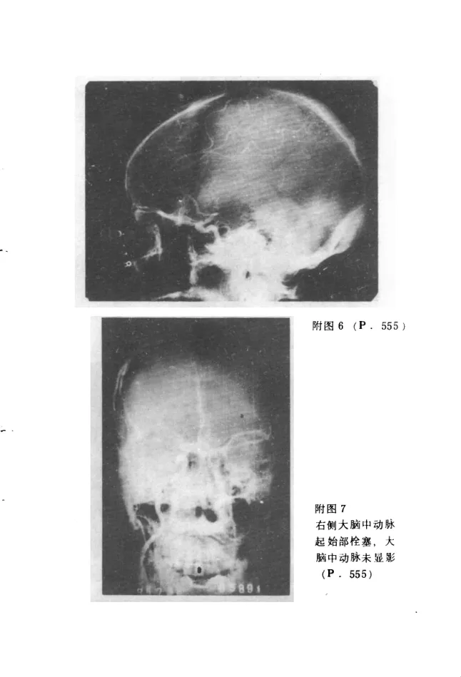 Source photographic or technical plate, PDF page 846
