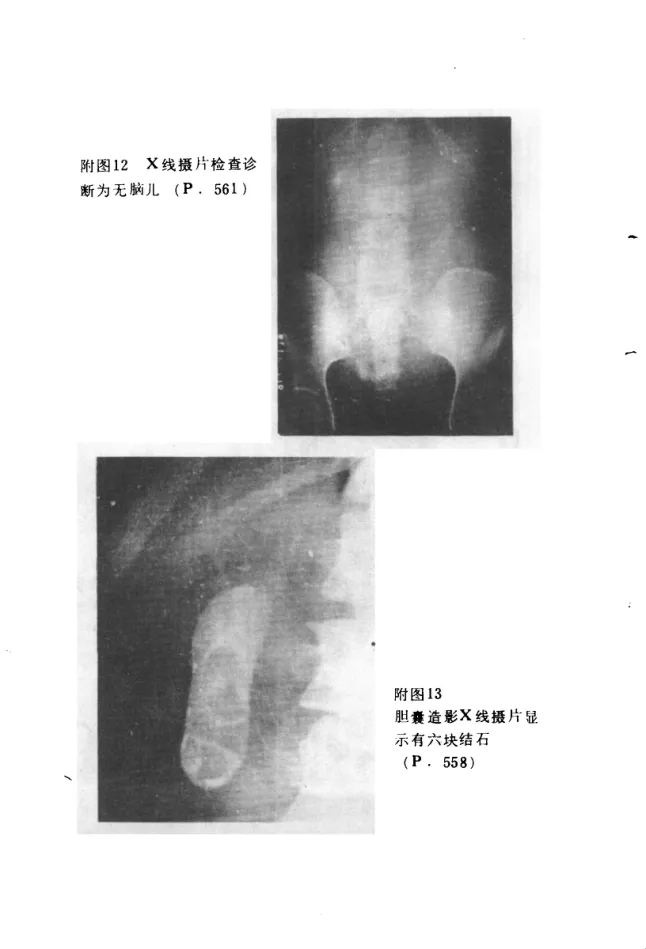 Source photographic or technical plate, PDF page 849