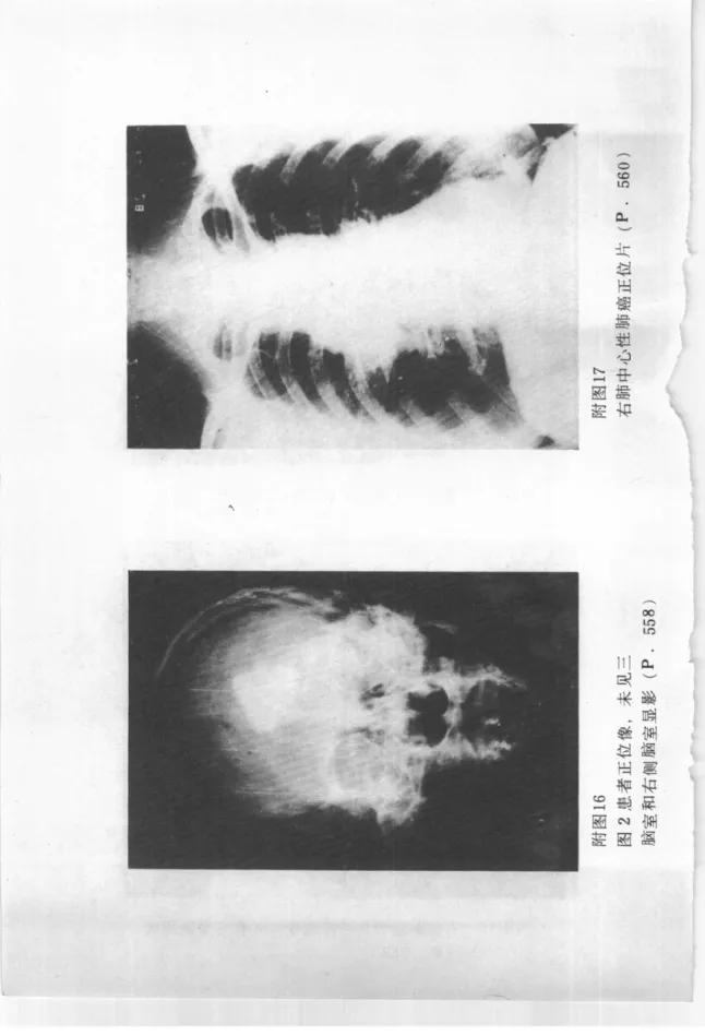 Source photographic or technical plate, PDF page 851