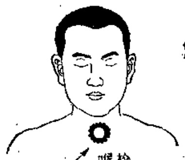 Source page 131: Source Figure 3