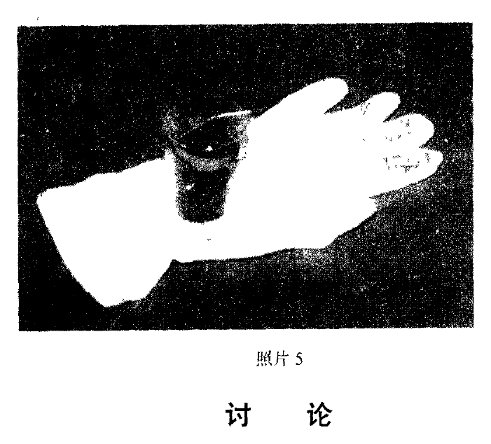Photo 5. Glove and experimental sample
