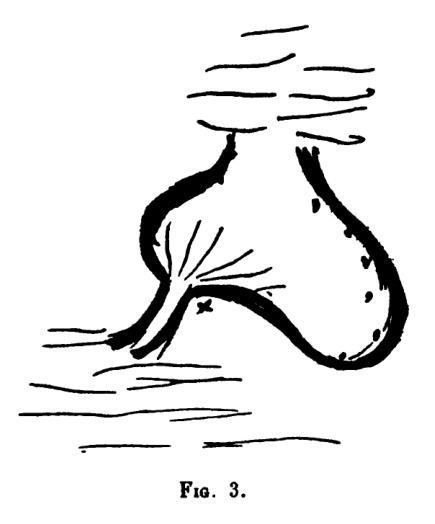 Figure 3: The patientâs drawing of her stomach