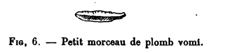Figure 6: Small piece of lead vomited up