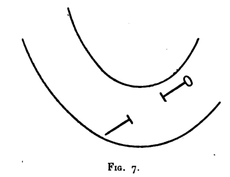 Figure 7: The patientâs drawing of the pin in the intestinal wall