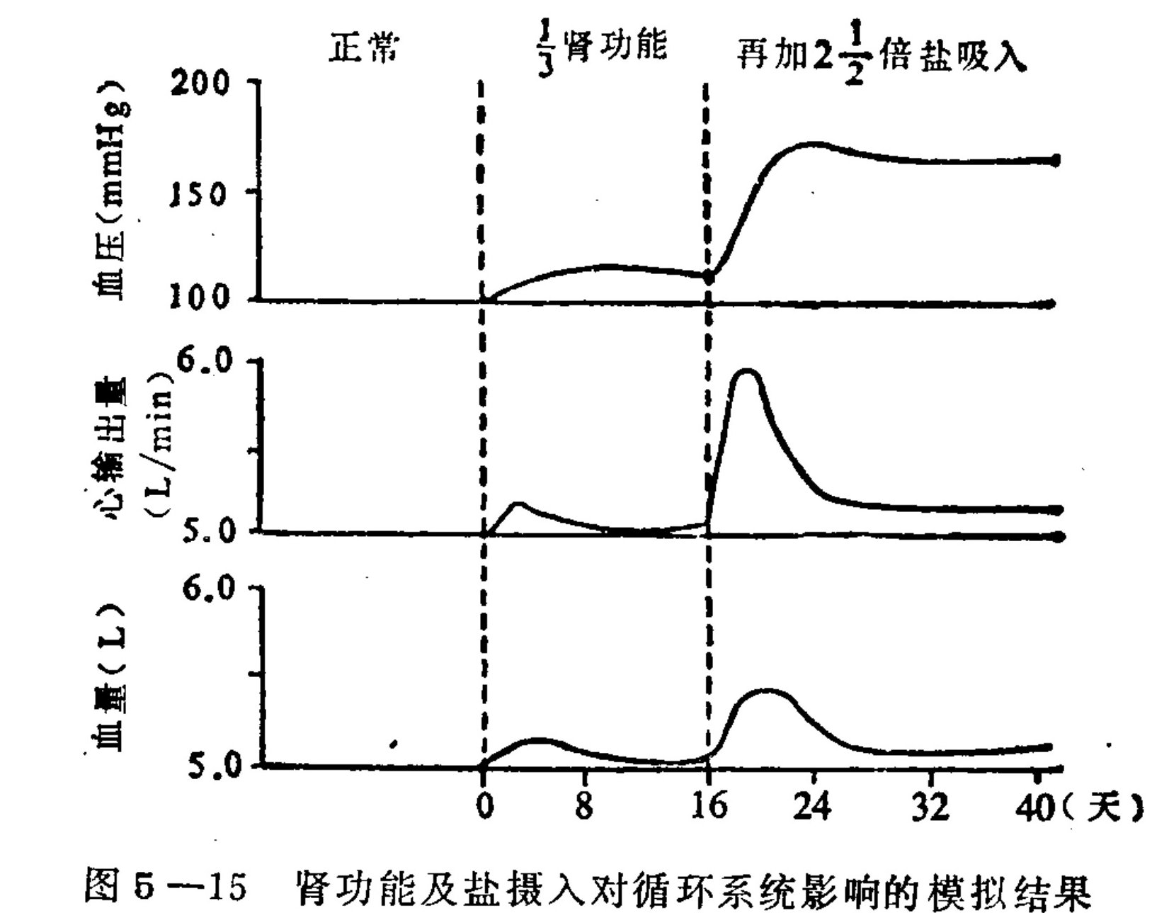 A multi-panel line graph showing simulated data over a 40-day period. The top panel plots Blood Pressure (mmHg), the middle panel plots Cardiac Output (L/min), and the bottom panel plots Blood Volume (L). Each panel contains two curves: a baseline flat line at zero or 5.0, and a fluctuating response curve. Vertical dashed lines divide the timeline into three phases labeled 'Normal', '1/3 Renal Function', and 'Plus 2 1/2 times salt intake'. The response curve shows significant increases in all three metrics during the second and third phases.