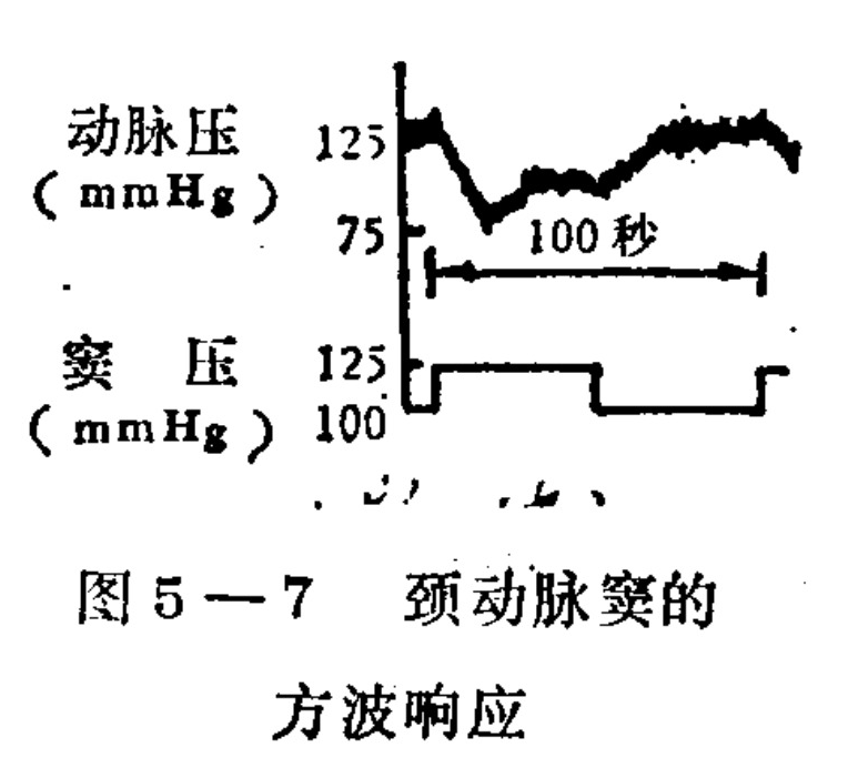 A scientific diagram showing two stacked line graphs. The top graph plots 'Arterial Pressure (mmHg)' on a vertical axis ranging from 75 to 125, displaying a curve that drops sharply and then gradually recovers over a marked duration of '100 seconds'. The bottom graph plots 'Sinus Pressure (mmHg)' on a vertical axis with values around 100 and 125, showing a step function with square-wave patterns. Chinese labels are present for the axes.