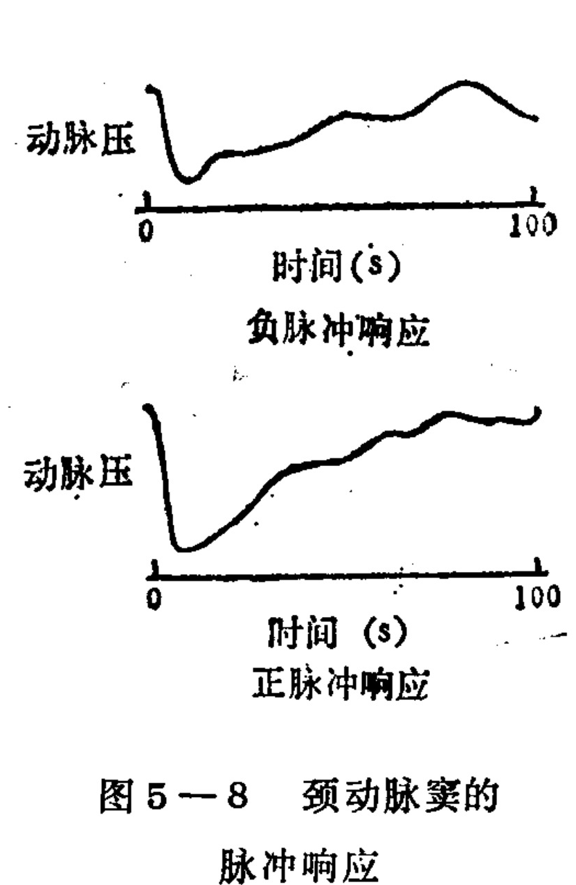 The image displays two vertically stacked line graphs illustrating physiological responses over time. Both graphs share a horizontal axis labeled 'Time (s)' ranging from 0 to 100 seconds, and a vertical axis labeled 'Arterial Pressure'. The top graph, titled 'Negative Pulse Response', shows an initial sharp drop in pressure followed by a gradual recovery with slight oscillations. The bottom graph, titled 'Positive Pulse Response', depicts a similar initial sharp decline but follows with a smoother, more consistent upward trend back toward the baseline.