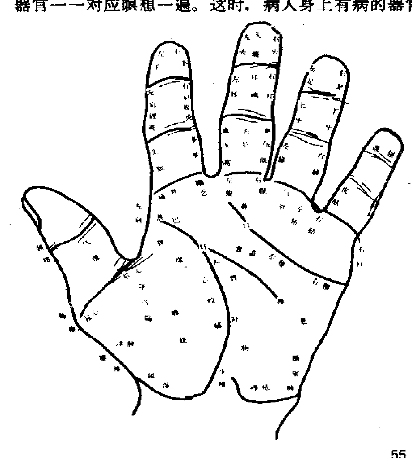 Source palm diagram used in the diagnostic exercise