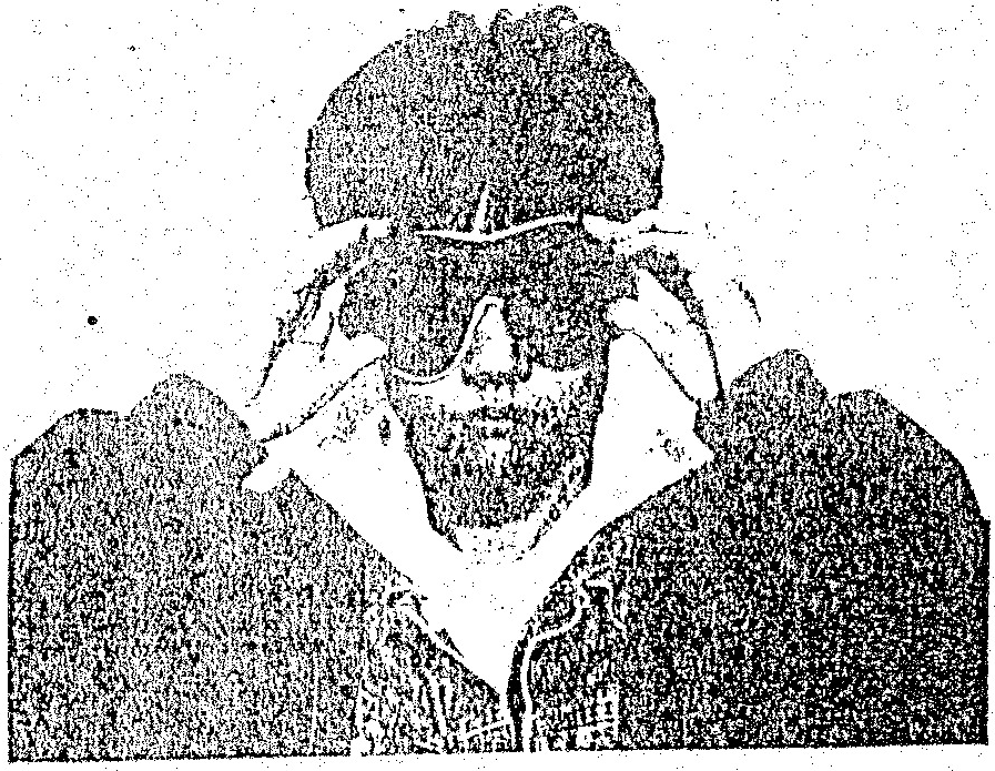 A black-and-white halftone illustration showing a person holding a large, circular, dark-rimmed viewing device to their eyes with both hands. The figure demonstrates a specific step in a vision training process.