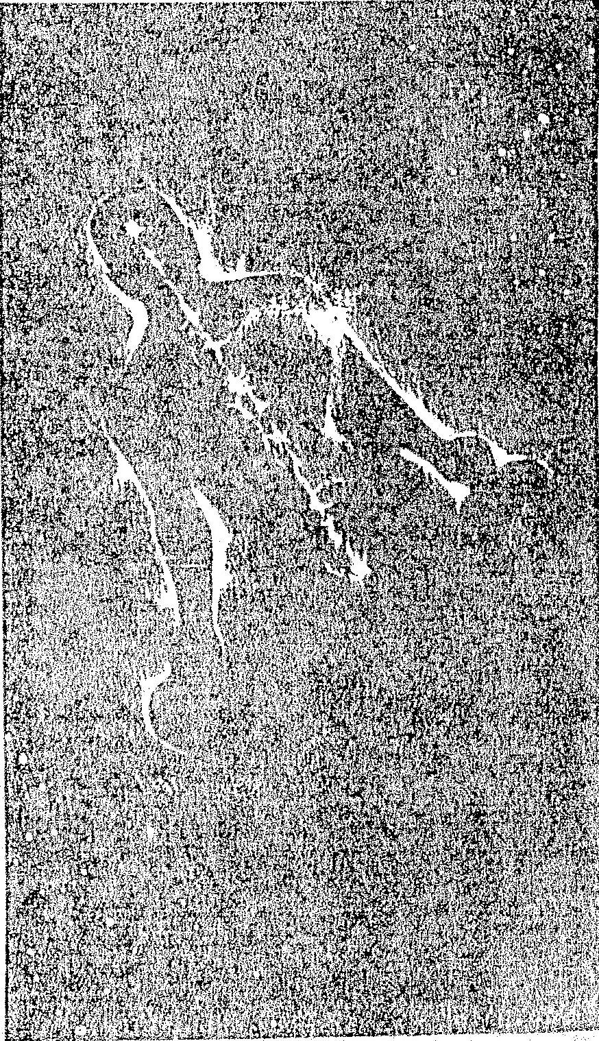 A grainy, monochromatic image showing light-colored, fluid-like streaks or organic shapes against a dark, textured background.