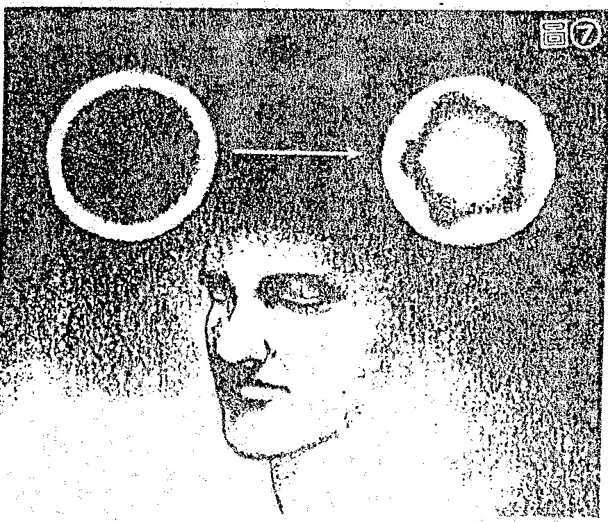 A monochrome illustration depicting a man's face with two circular inset diagrams above his head, illustrating stages of visual perception or light-based imagery.