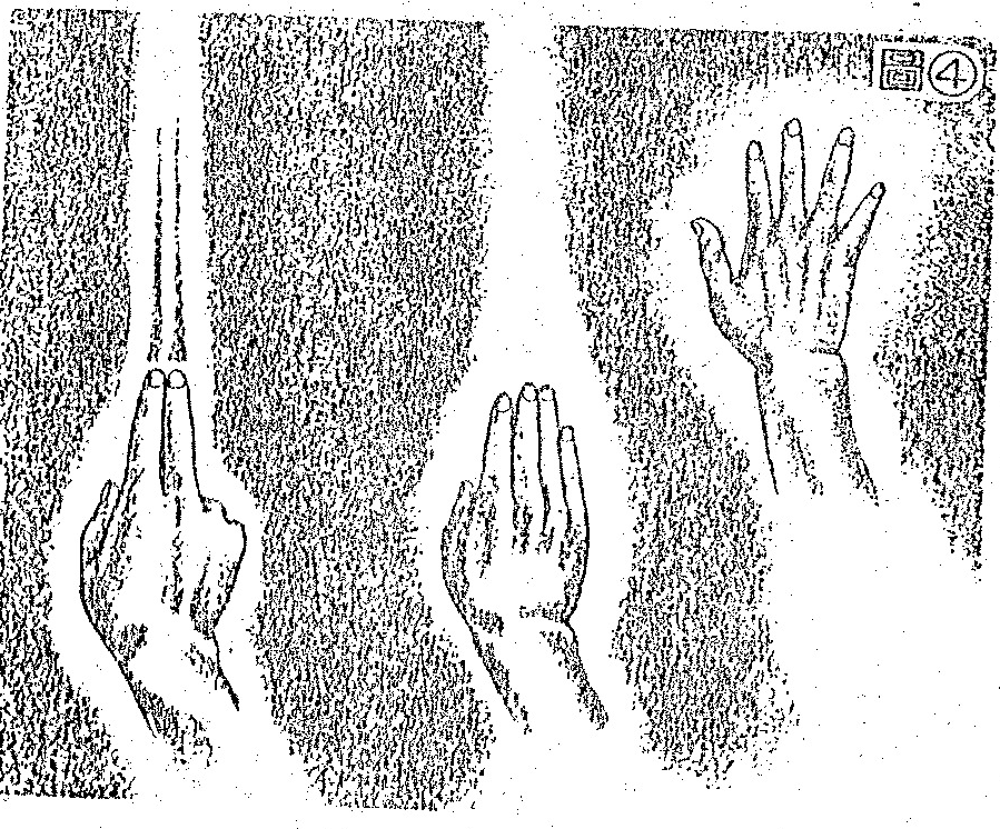A figure showing two hands with light rays emanating from the fingertips.