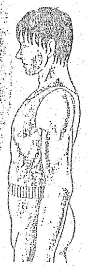 Source visual from PDF page 72