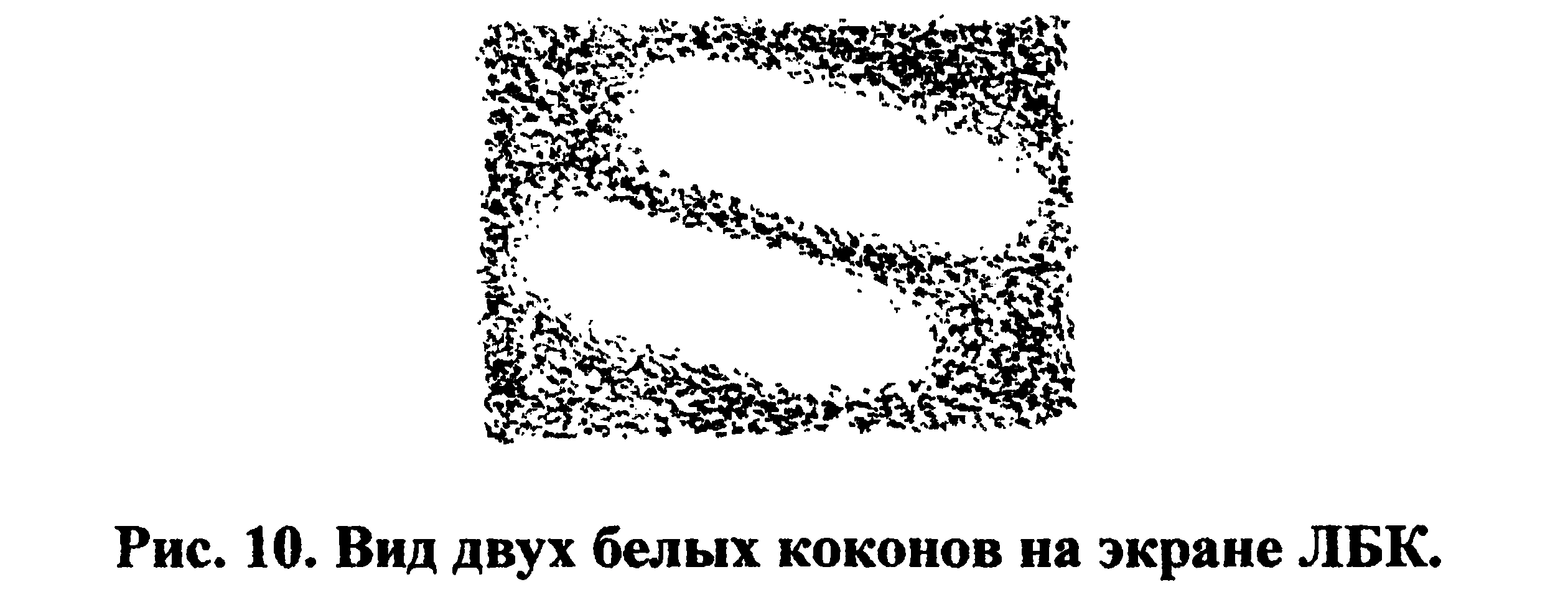 Figure 10: Two white cocoons on the light-biocomputer screen