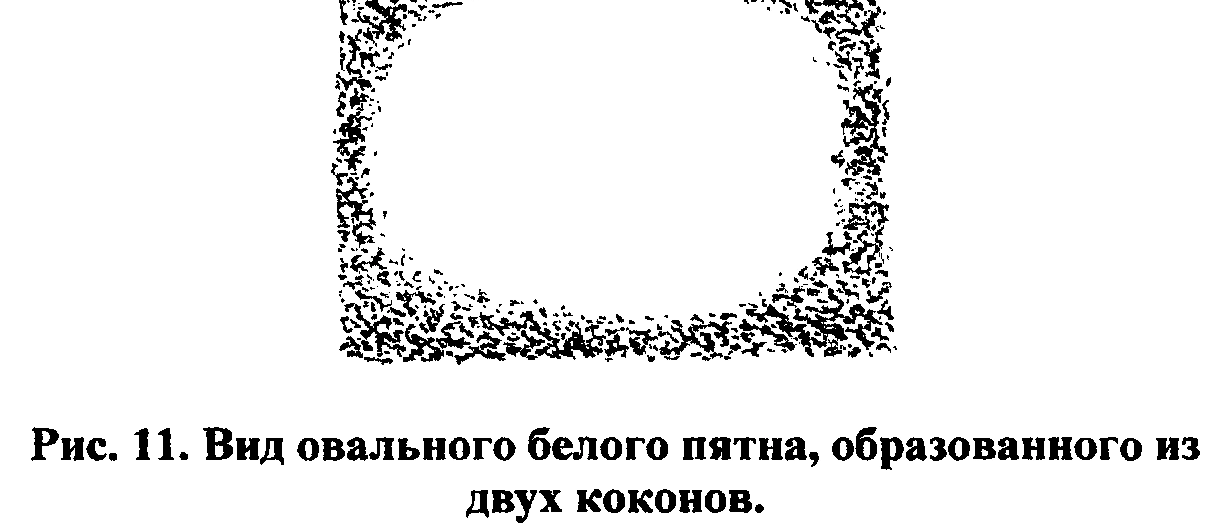 Figure 11: Oval white spot formed from two cocoons