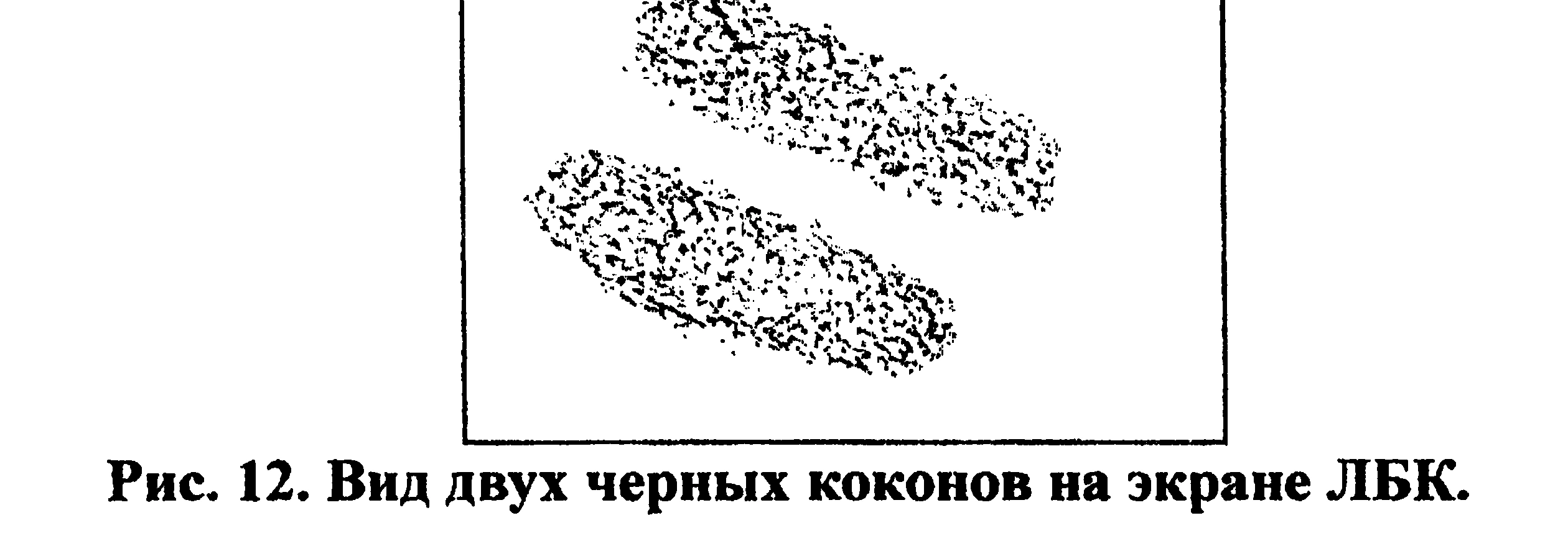 Figure 12: Two black cocoons on the light-biocomputer screen